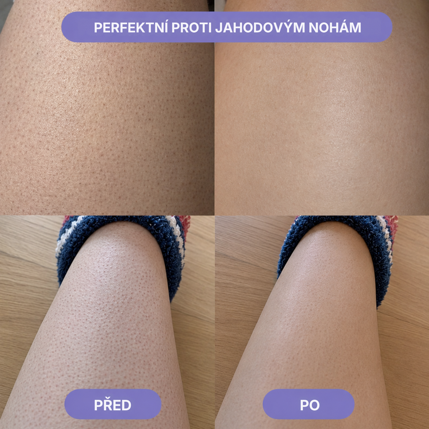 Skinora – nano skleněný odstraňovač chloupků