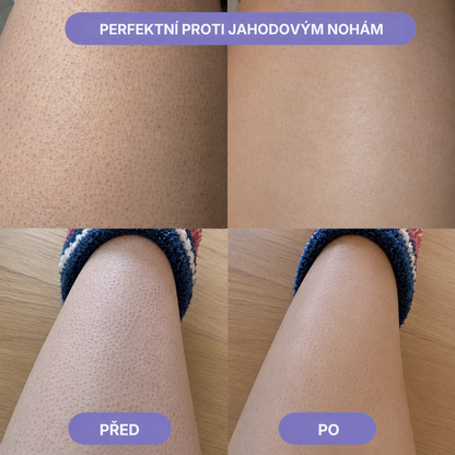 Skinora – nano skleněný odstraňovač chloupků